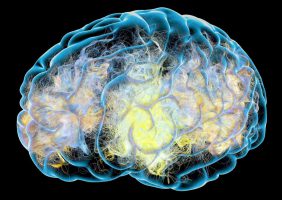 Brain activity Parkinsons image