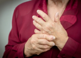 painful arthritic hands